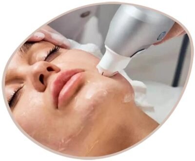 ultraformer-iii-reduz-rugas-e-linhas-finas Ultraformer Reduz Linhas Fina e Rugas