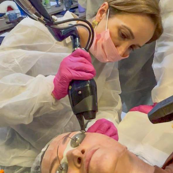 Laser CO2 para Estimular o Colágeno