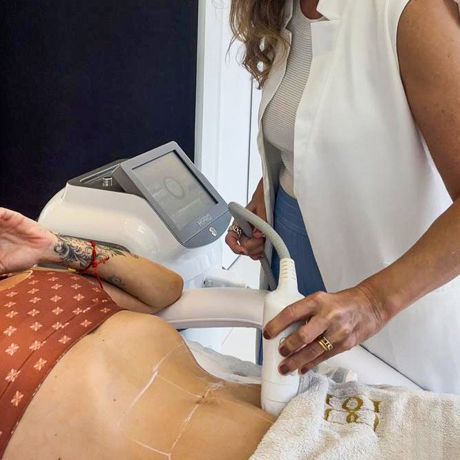 HIPRO para Lifting Facial e Corporal (Flacidez e Gordura Localizada)Desanexar